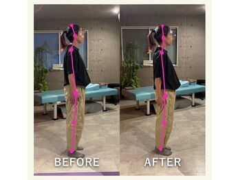 エイムハイ(Aim high)の写真/不調を解消するだけでなく、姿勢の乱れの要因になる筋肉の強張りの深層部までアプローチ!美しい姿勢に♪
