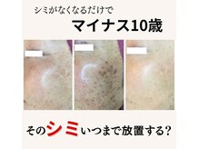 美人の雰囲気（結果重視☆シミケア）