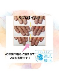 40年間爪を噛んでいた