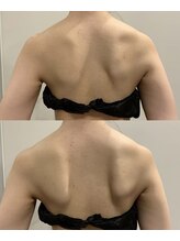 パリスヒロトン(PARIS HIROTON)/肩甲骨や肩こりケア