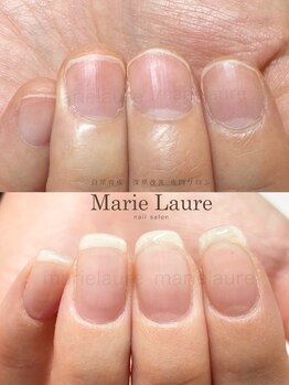 マリーロール 天王寺店(Marie Laure)/深爪矯正/自爪育成/ネイルケア