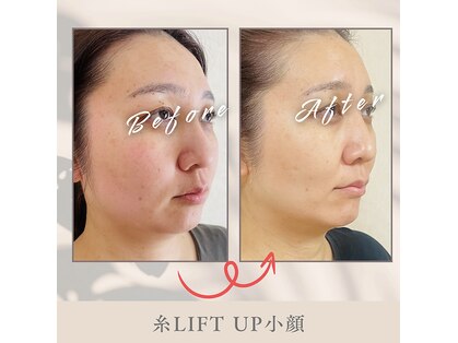 ルアナラウンジ(Luana Lounge)の写真
