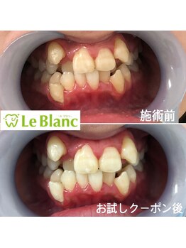 ルブラン 奈良店(Le Blanc)/大事なイベント前に!