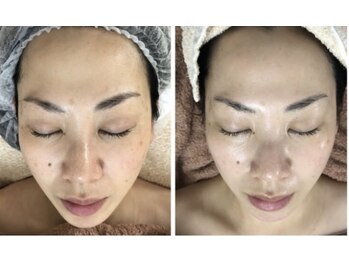 アルページュ(Arpege)/肌を強力活性リアボーテハーブ♪