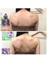 ロココ 岐阜店(Rococo)/背中から中心に骨格改善！