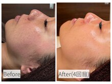 サロン ド プリリ(Salon de Puriri)