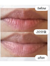 ピーロ ルレ(salon Piilo Rule)/リップエステ