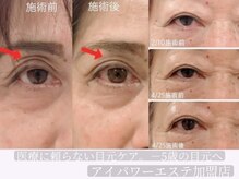 ウィズティ(with.T)