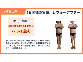 アルファ(alpha)/