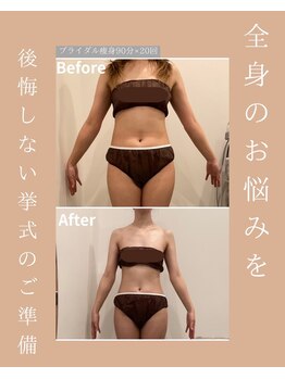 メゾンワン(maison one)/理想の花嫁体型へ