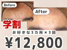 エピ エピ プラス イオンモール宇城店(EPI*EPI+)