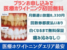 スマイルホワイト 練馬店