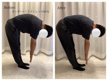 ワン ストレッチ(ONE stretch)/【30代男性before・after】