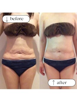 ユウキ(yuuki)/たるみもスッキリ！見た目美人！