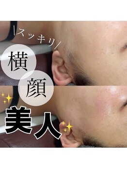 エレーナ(ELENA)/白玉WAX