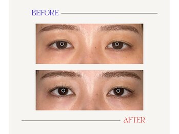 はりと美容鍼灸治療院(HaRi&美容鍼灸治療院)/