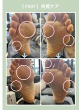 プティットスリール アイラッシュ 豊田店(Petit Sourire Eyelash)/【角質ケア】スクラブパックなし