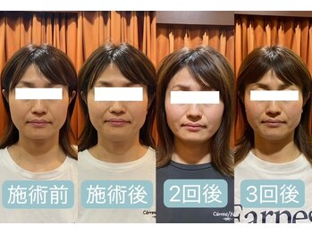 すわ鍼灸整骨院/継続することでよりスッキリ◎