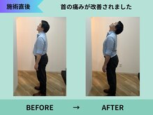 トミーリハ整体院(TOMMY REHA整体院)/首の可動域があがります！