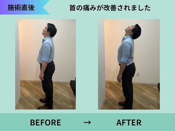 トミーリハ整体院(TOMMY REHA整体院)/首の可動域があがります！
