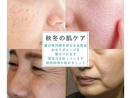 ピュリフィケーション(Purification)の写真