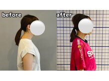 マックストレーニングラボ(MAX TRAININGLABO)/スマホ首に変化が！