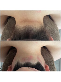 ミース 北九州店/うなじ△ビフォーアフター