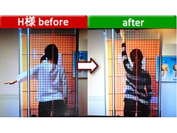 アセルカイロプラクティック/肩痛みケア　阿佐ヶ谷/カイロ