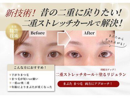 ビーケアズビューティー(be-cares beauty)の写真