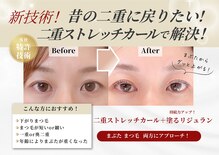 ビーケアズビューティー(be-cares beauty)
