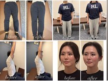 あかり鍼灸 接骨院プラス 南草津院(あかり鍼灸 接骨院PLUS)の雰囲気（反り腰・骨盤の傾き・下半身太り・むくみ・肩こり・たるみ改善）