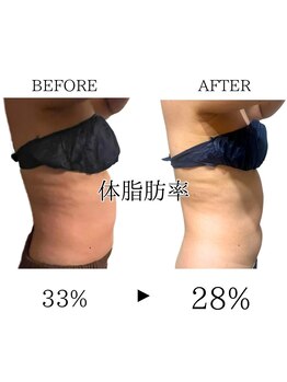 ワン ストレッチ(ONE stretch)/【体脂肪率減少】