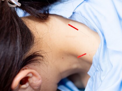 狭山池尻みやび鍼灸マッサージ院の写真