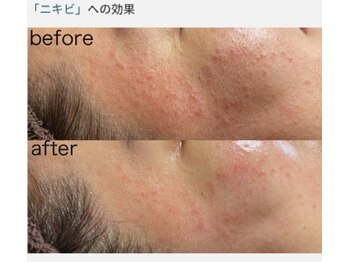 サロンド エステ ミニョン(salon de esthe mignon)/ラミネーションピール