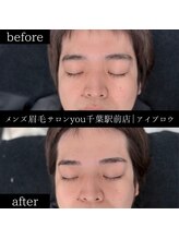 ユー 千葉駅前店(you)/ビフォ－アフター写真