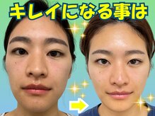 ナチュラルビューティーフェイス 横浜(NBF)