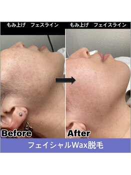 サロンシュシュ(salon Chou Chou)/フェイシャルワックス