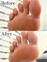 シンデレラジェル(シンデレラGEL)/足裏角質ケア