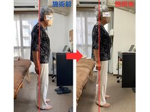 整体院 澄/姿勢改善