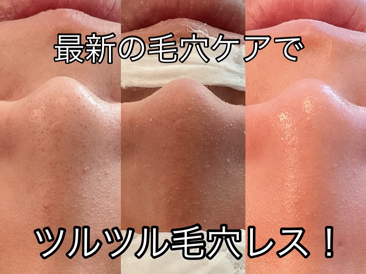 毛穴エステ 込900円 伊勢原市で毛穴洗浄・毛穴吸引が人気のエステサロン