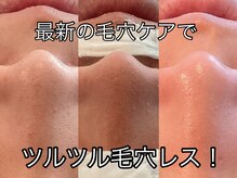エナン(enan)