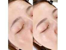 ホワイトアイ 加古川(WHITE EYE)の雰囲気（フェイスwaxでつるんと卵肌に♪）