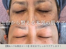 ピュア 川越店の雰囲気（【極上エイジング】艶＆ハリ＆美白パーフェクトコース）