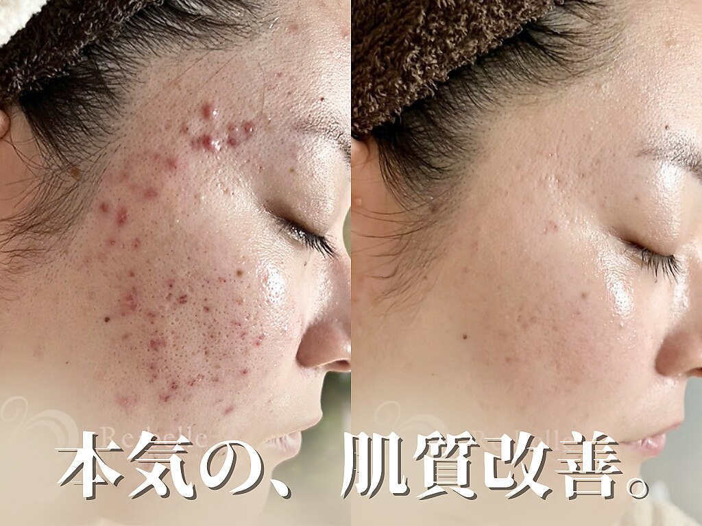 名古屋市東区で美肌が人気のエステサロン|ホットペッパービューティー 名古屋市東区で美肌が人気のエステサロン|ホットペッパービューティー