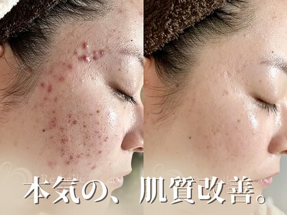 リソルバイスリール(Re:sol by sourire)の写真