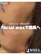 ジェノール 飾磨本店(JNOEL)/フェイシャルWaxで極上艶肌！