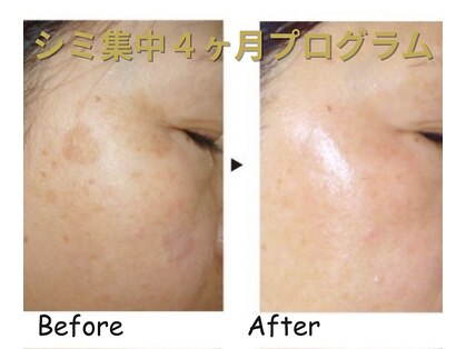 クレヴィアの写真