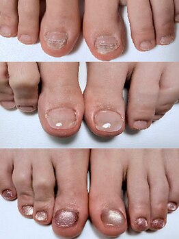 爪の悩みを解消できる（ケア含む）