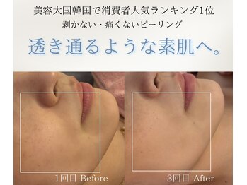 ユフラ(Juhla)/ララピール