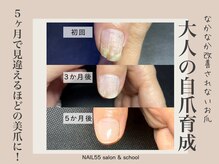 ネイルゴーゴー(NAIL55)/縦割れ改善！